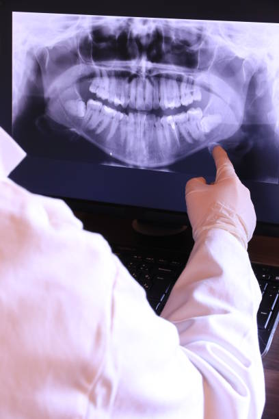 Best Dentist for Tooth Abscess  in Suffern, NY