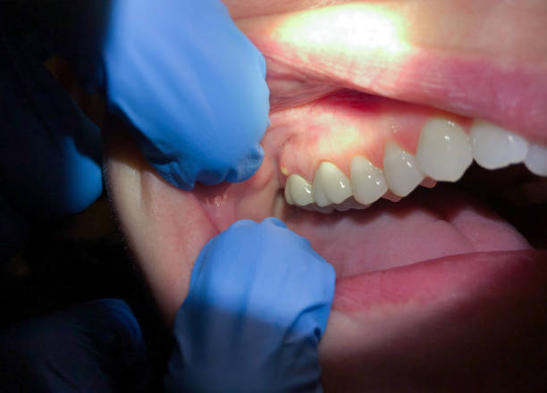 Best Tooth Infection Emergency Dentist  in Suffern, NY